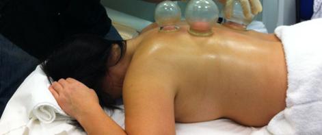 Cupping